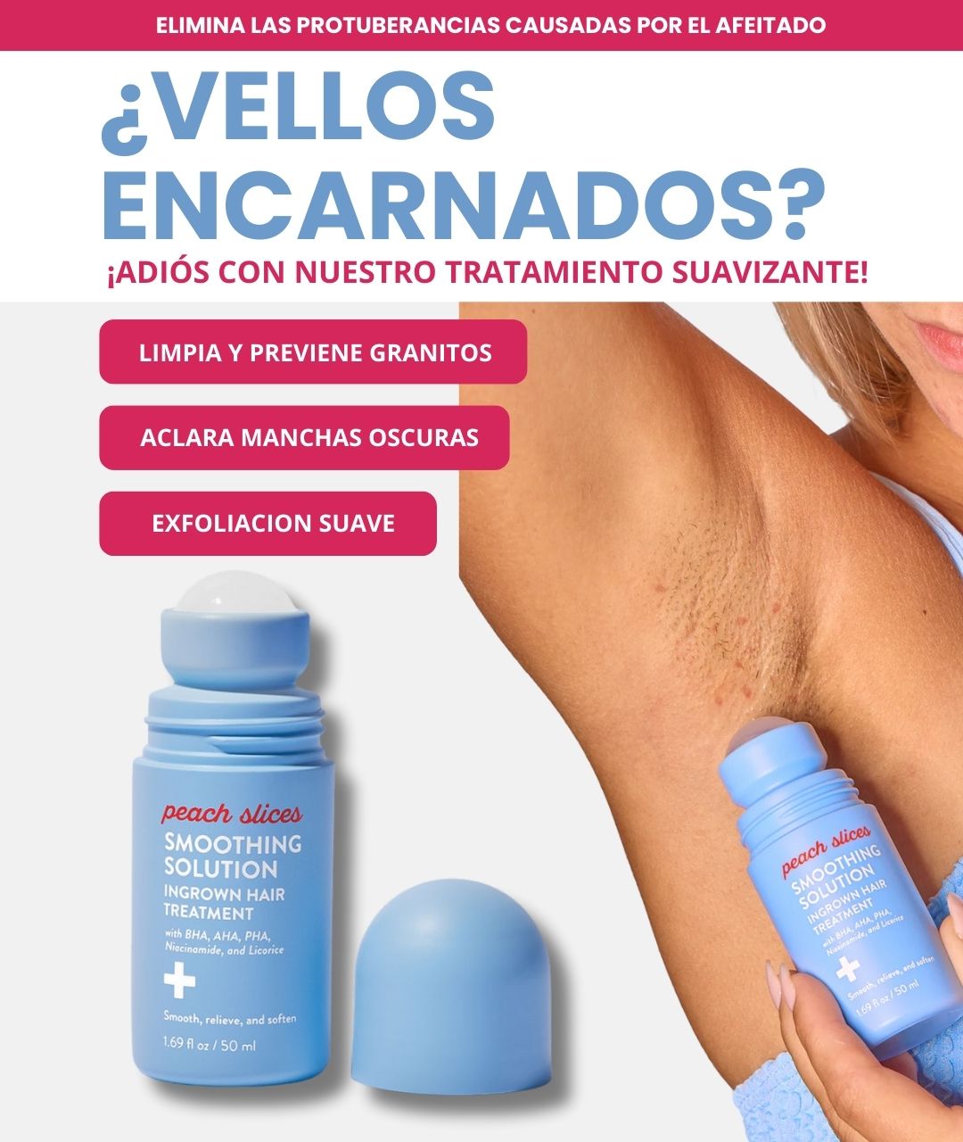 Tratamiento de vellos encarnados